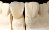 Geo5 - K2 CAD / CAM Zirconia