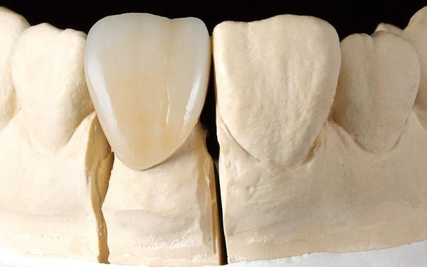 Geo5 - K2 CAD / CAM Zirconia